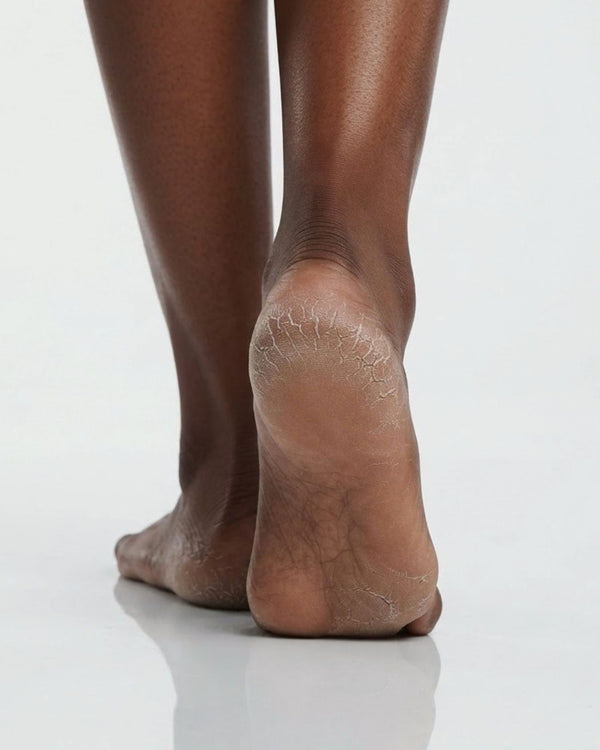 Dry patches